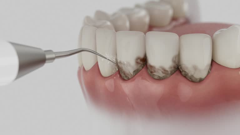 Reliable Dental Implants contractor in Radisson, NY by Smile Center Dentistry